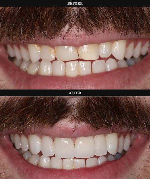 Patient smile transformation