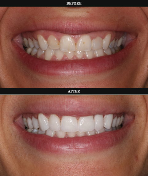 Dental treatment before and after